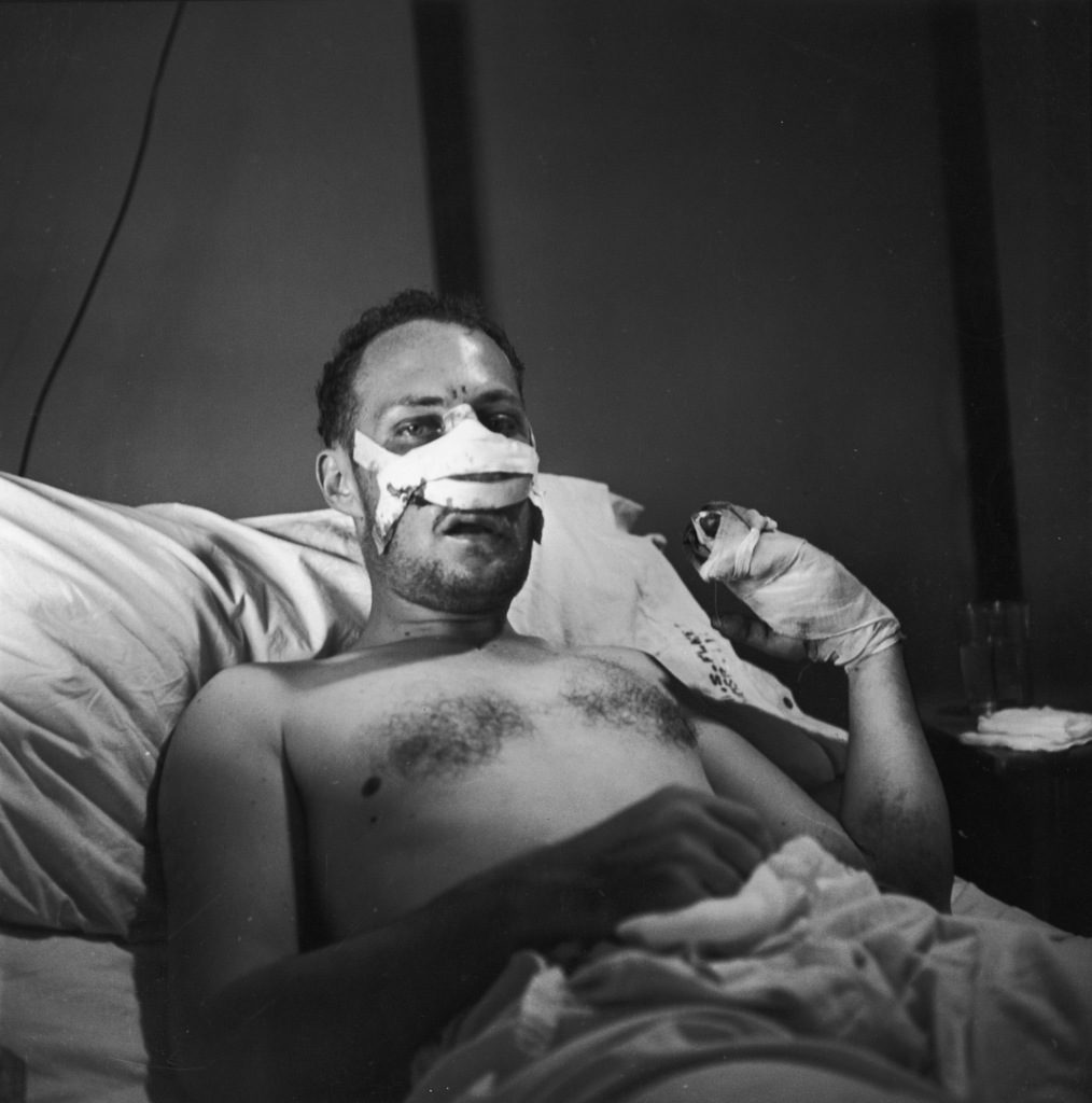W. Eugene Smith, wounded by mortar fire while covering the action on Okinawa, recovering in a Guam field hospital. (Photo by W. Eugene Smith/The LIFE Picture Collection © Meredith Corporation)