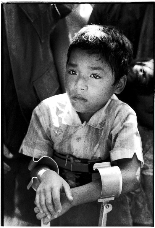 Paraplegic Lau Nguyen, 10, Vietnam, 1970. (Photo by Larry Burrows/The LIFE Picture Collection © Meredith Corporation)