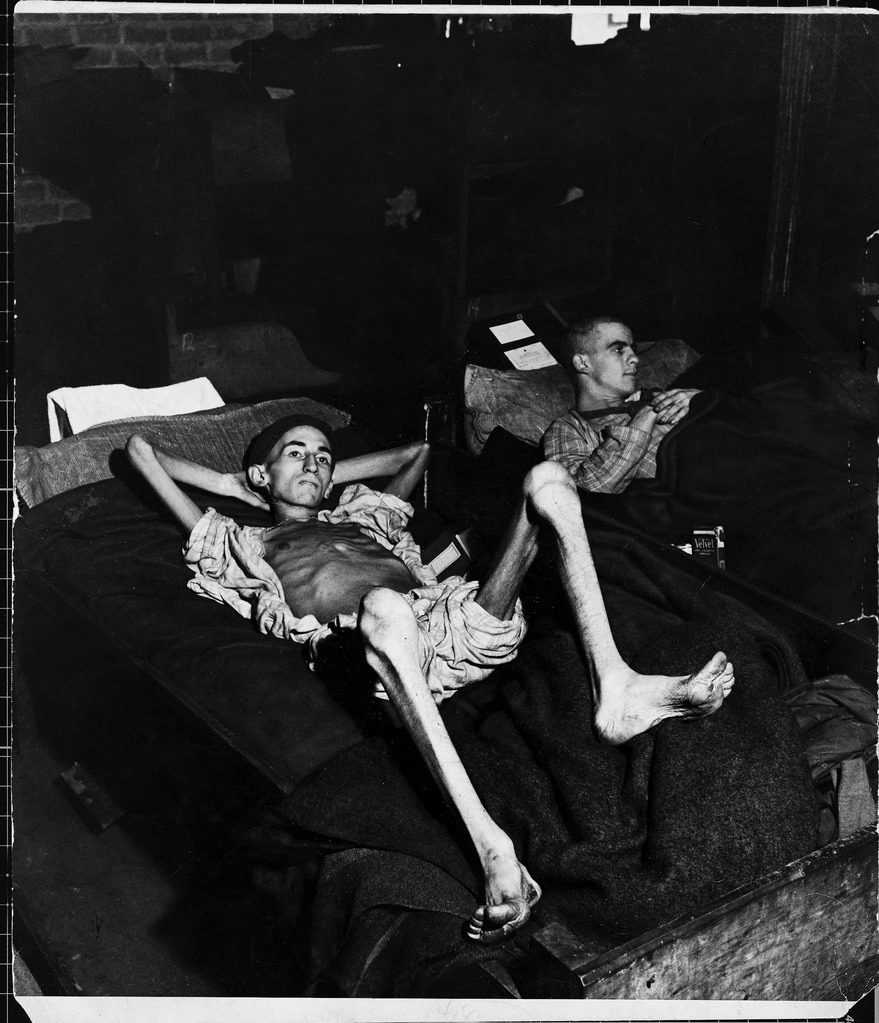Private Joe Demler, a prisoner of the Germans for 3 months, revealing his skeleton-like limbs as he lies on cot. (Photo by John Florea/The LIFE Picture Collection © Meredith Corporation)